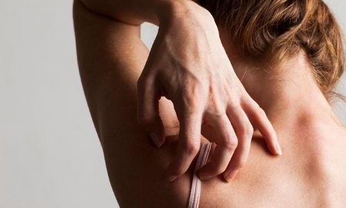¿Cómo afecta la diabetes a la piel? Piel irritada, picazón y extrema sequedad.